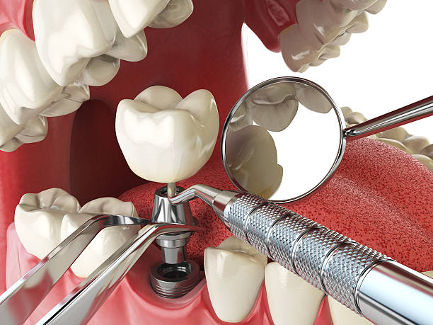 Best Emergency Treatment for Oral Infections in Dacula, GA